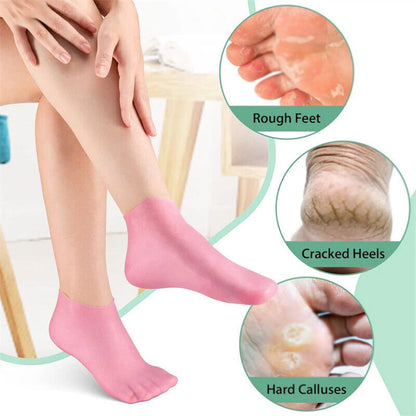 Silicone Moisturizing Gel Socks for Cracked Heels & Dry Skin (1 Pair, Pink)