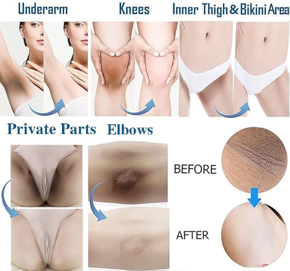 Whitening Cream for Sensitive Areas  underarm 7 days result cream.