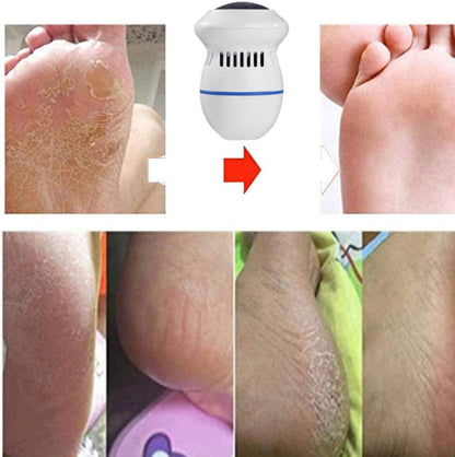Electric Foot Callus Remover
